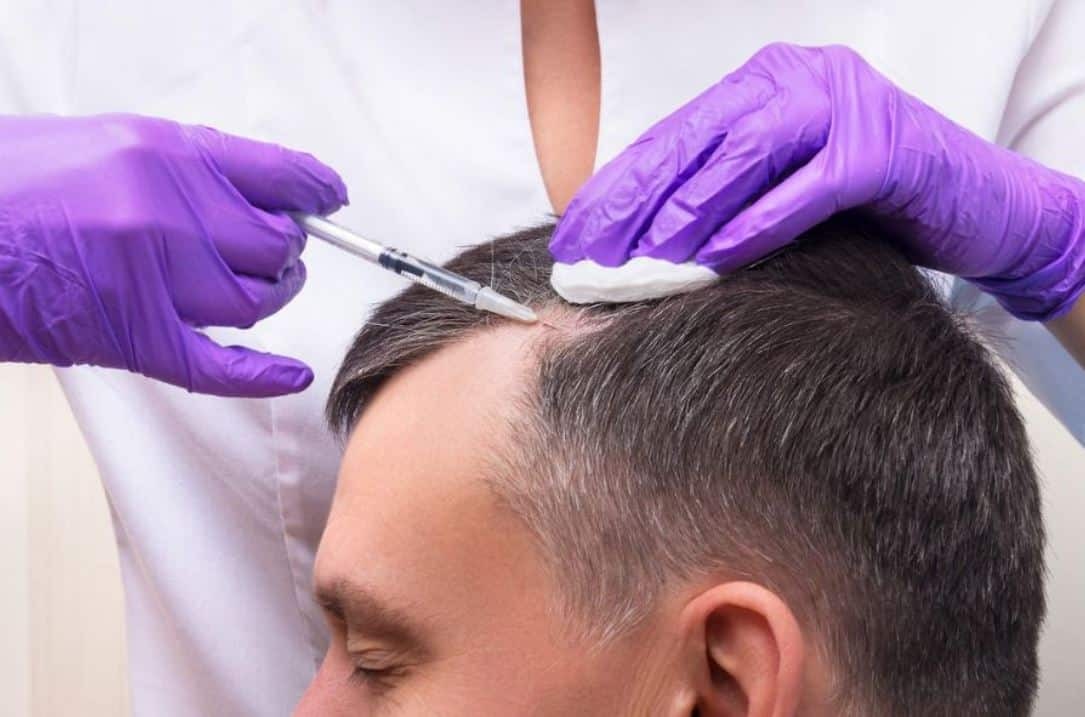 Haartransplantation klinik: Eine persönliche Reise zur Haarwiederherstellung