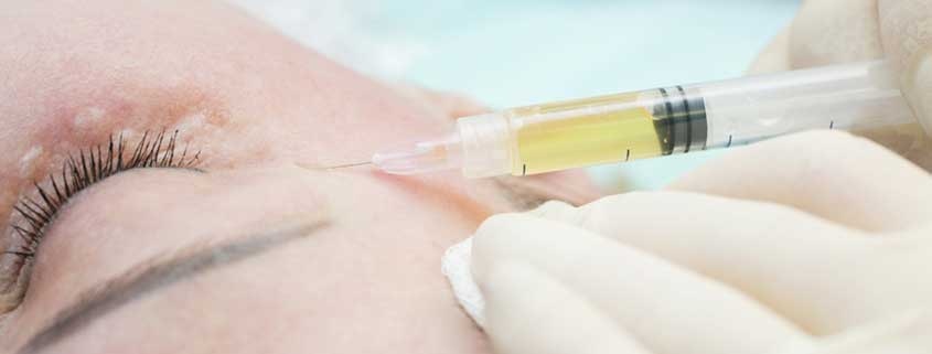 PRP Berlin: Die revolutionäre PRP Therapie bei The Hair Bank Berlin für Ihr Haarwachstum