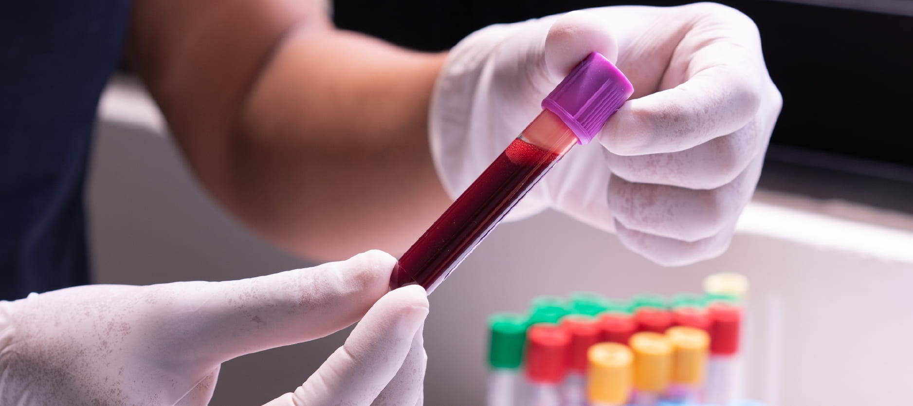 Warum die Präanalytik über den Erfolg jeder Blutabnahme entscheidet