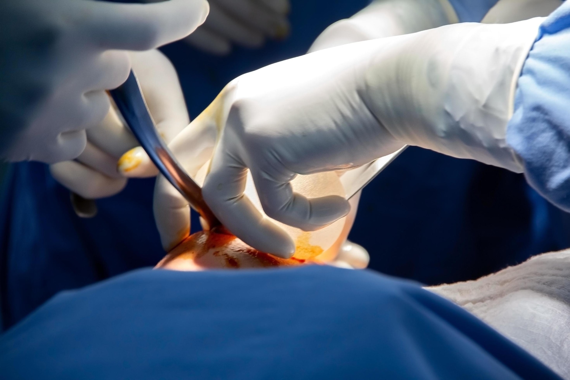 Plastische Chirurgie Bochum: Expertise in Körperformung und Ästhetik